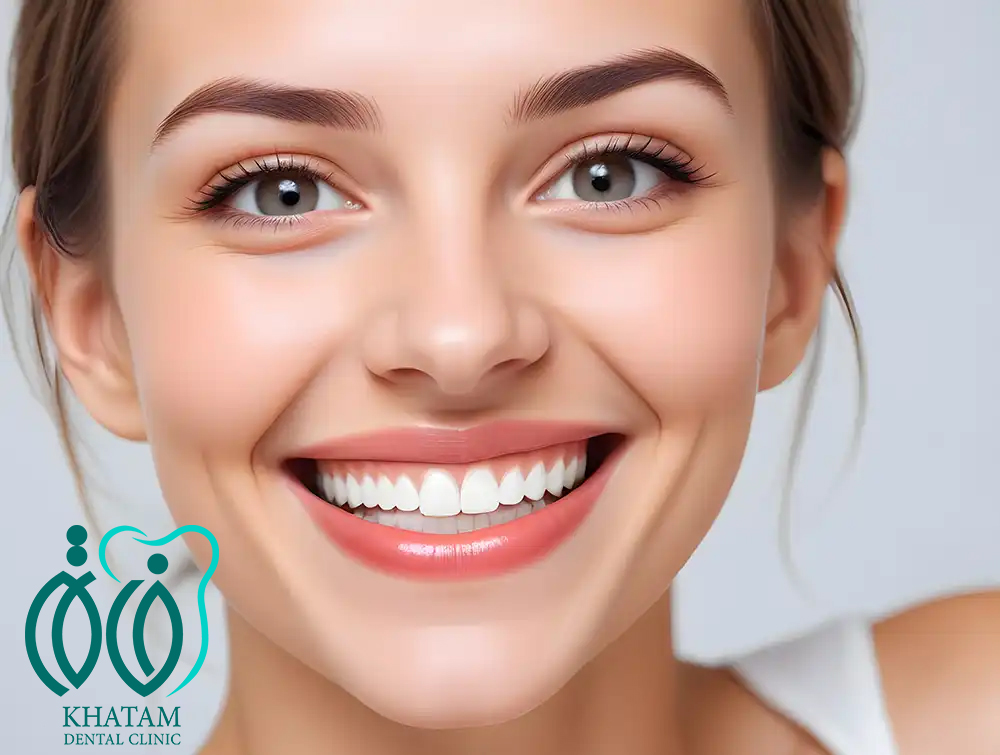 انواع لمینت دندان انواع لمینت دندان