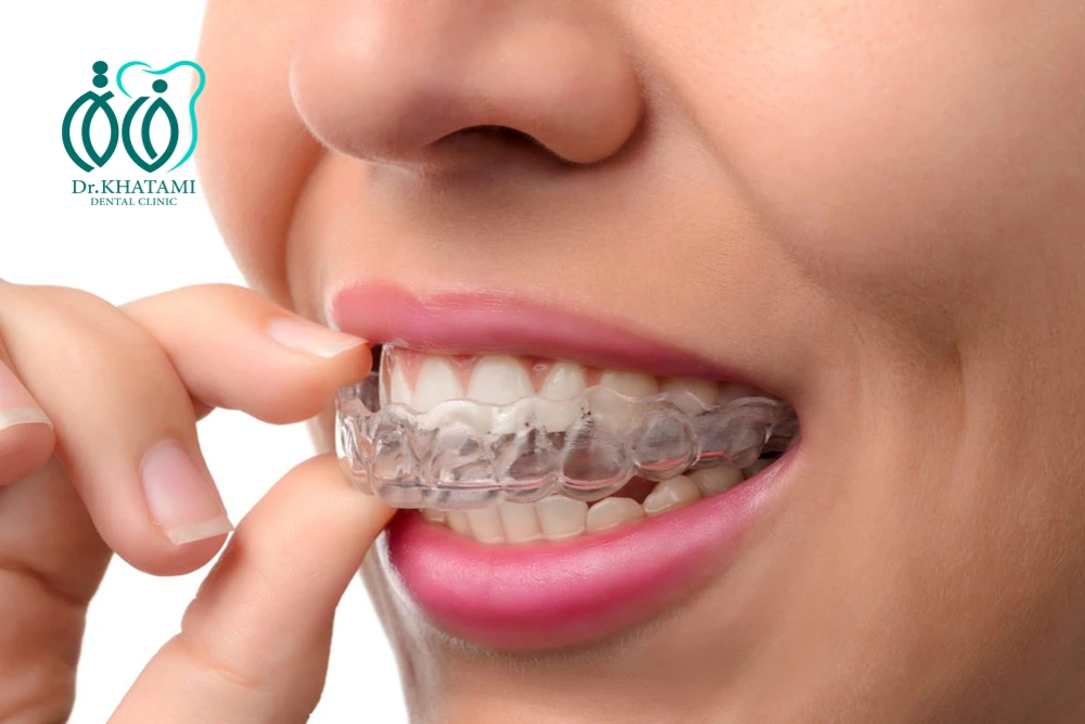 ارتودنسی نامرئی در مشهد + قیمت (اقساط) +مراحل، مزایا و معایب ارتودنسی نامرئی در مشهد + قیمت (اقساط) +مراحل، مزایا و معایب