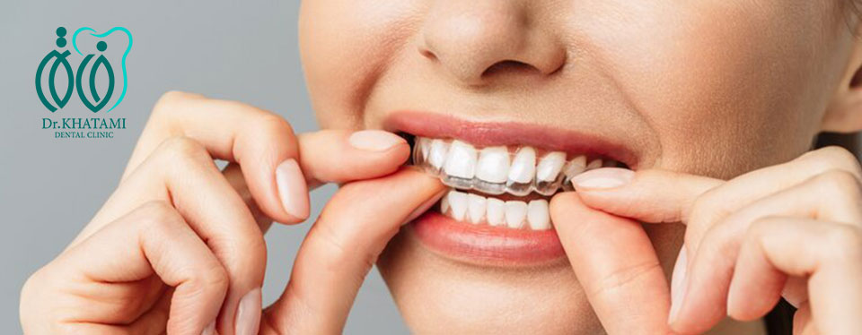 ارتودنسی متحرک چیست و چه کسانی میتوانند از آن استفاده کنند؟ ارتودنسی متحرک چیست و چه کسانی میتوانند از آن استفاده کنند؟