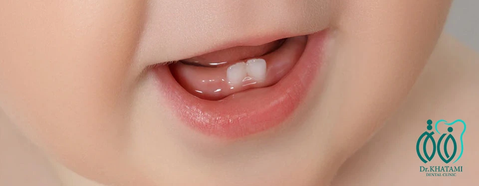 همه چیز درباره دندان های شیری کودکان همه چیز درباره دندان های شیری کودکان