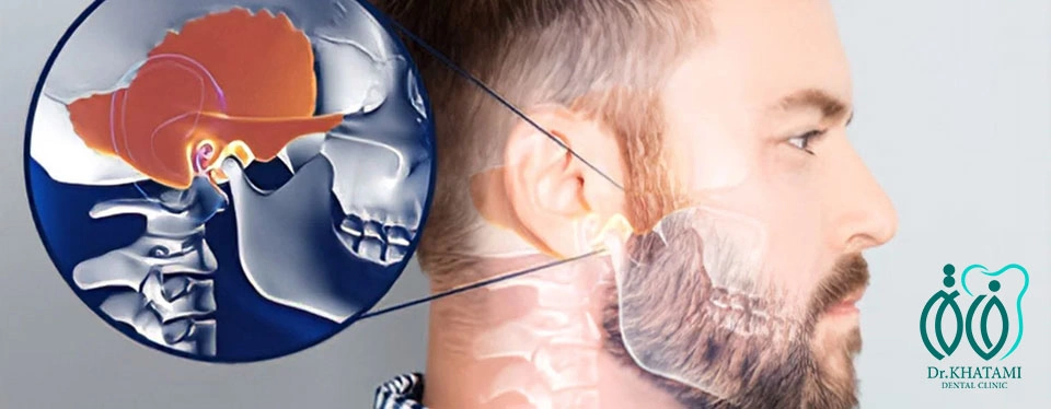 اختلال مفصل گیجگاهی (TMJ) و درمان درد فک اختلال مفصل گیجگاهی (TMJ) و درمان درد فک