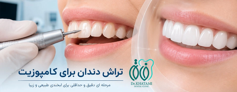 آیا کامپوزیت دندان نیاز به تراش دارد؟ آیا کامپوزیت دندان نیاز به تراش دارد؟