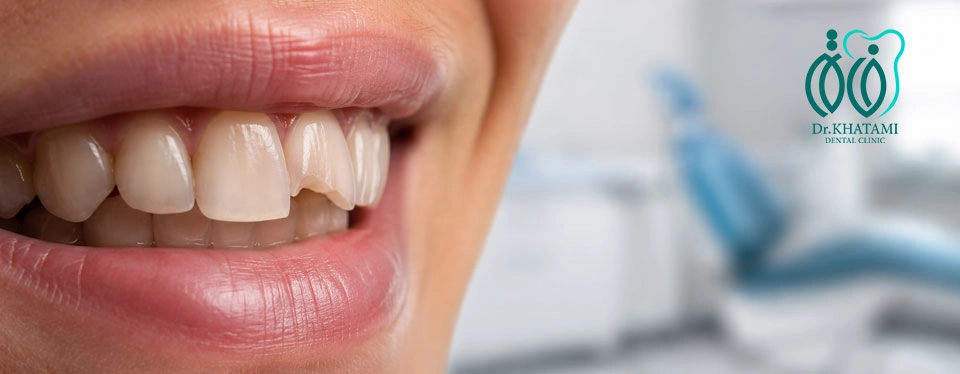 علت لب پریدگی و کوتاه شدن دندانها چیست؟ علت لب پریدگی و کوتاه شدن دندانها چیست؟