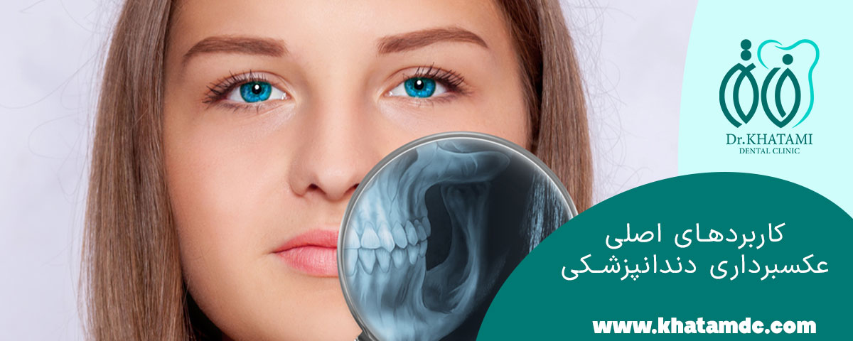 کاربردهای اصلی عکسبرداری دندانپزشکی