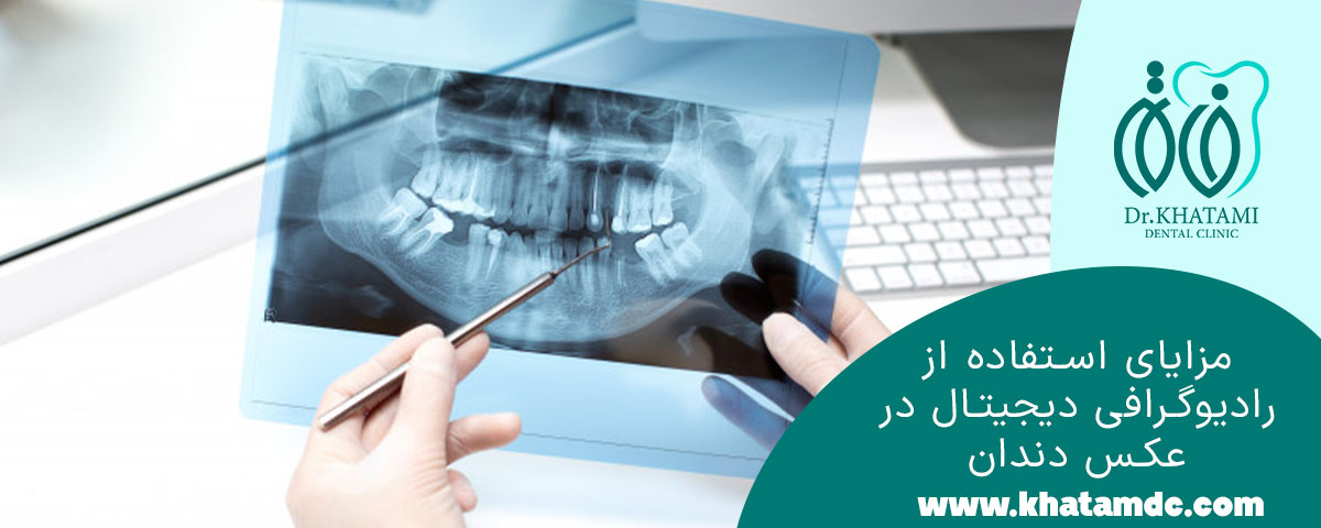 مزایای استفاده از رادیوگرافی دیجیتال در عکس دندان
