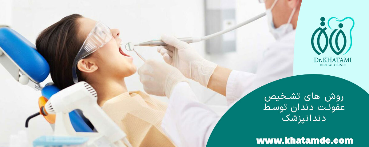 	روش‌ های تشخیص عفونت دندان توسط دندانپزشک
