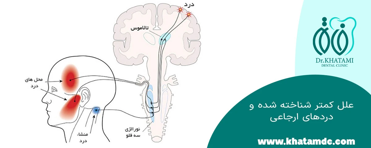 درد