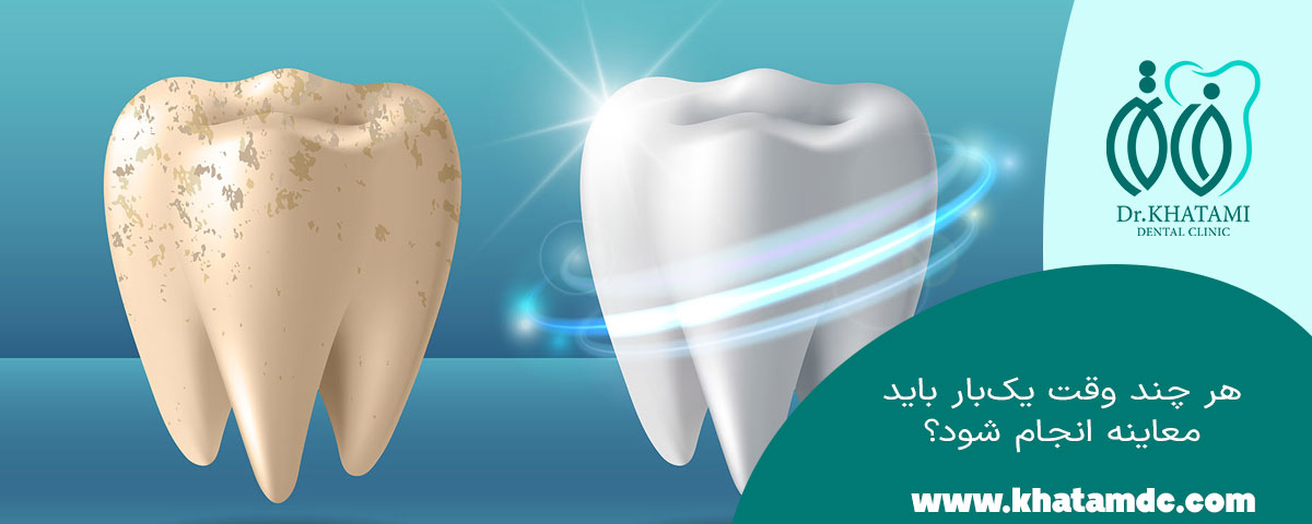 معاینه