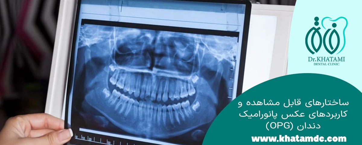 کاربرد عکس