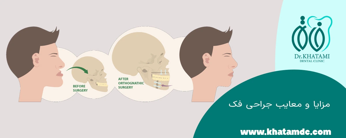 مزایا و معایب