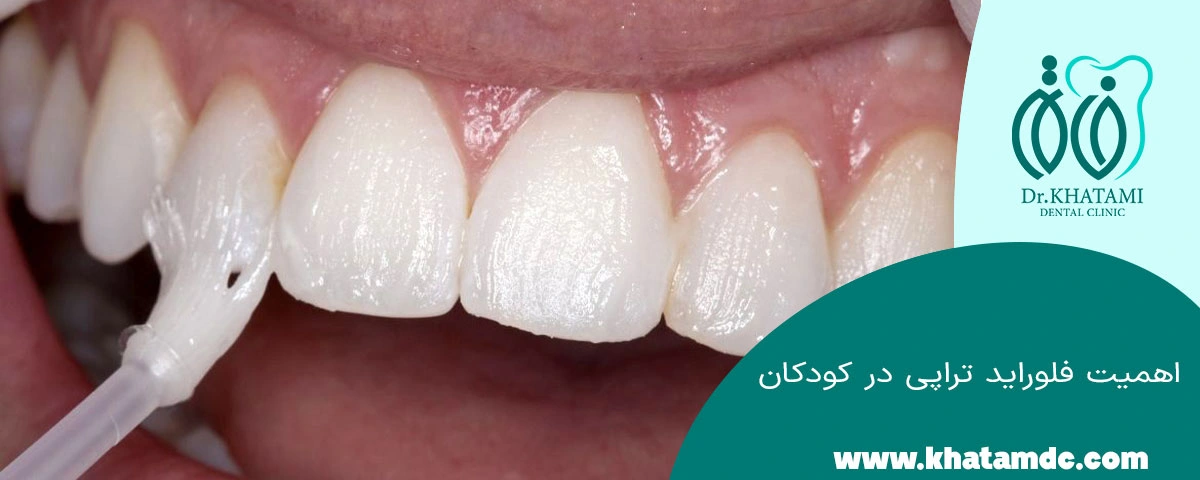 فلوراید کودک
