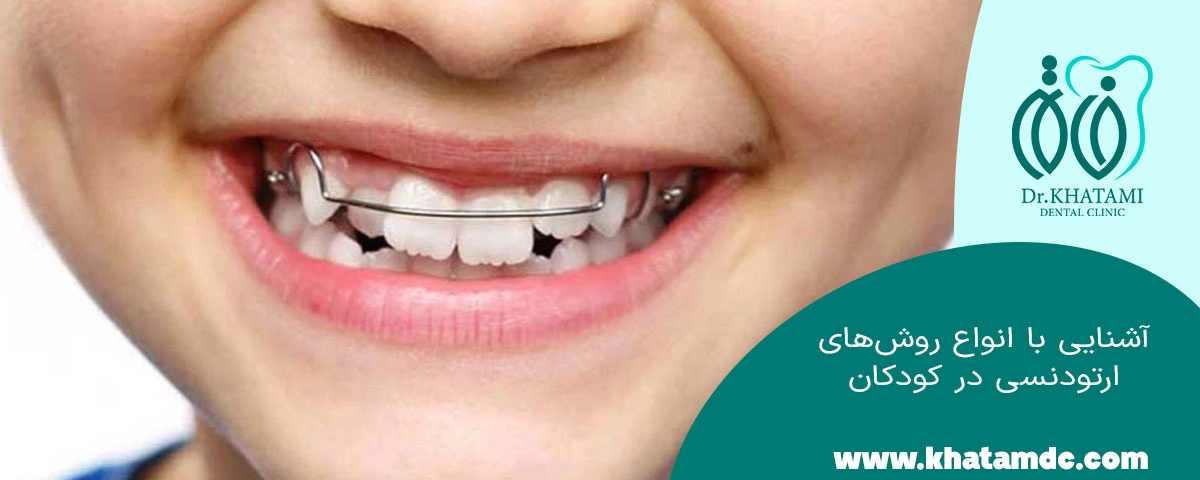 روش های ارتودنسی