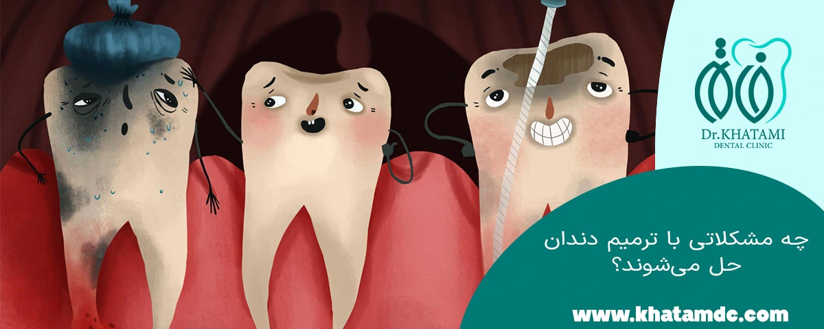 دلایل نیاز به ترمیم دندان