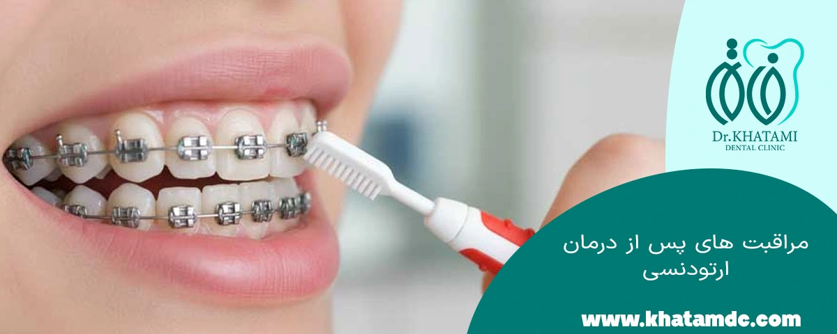 مراقبت