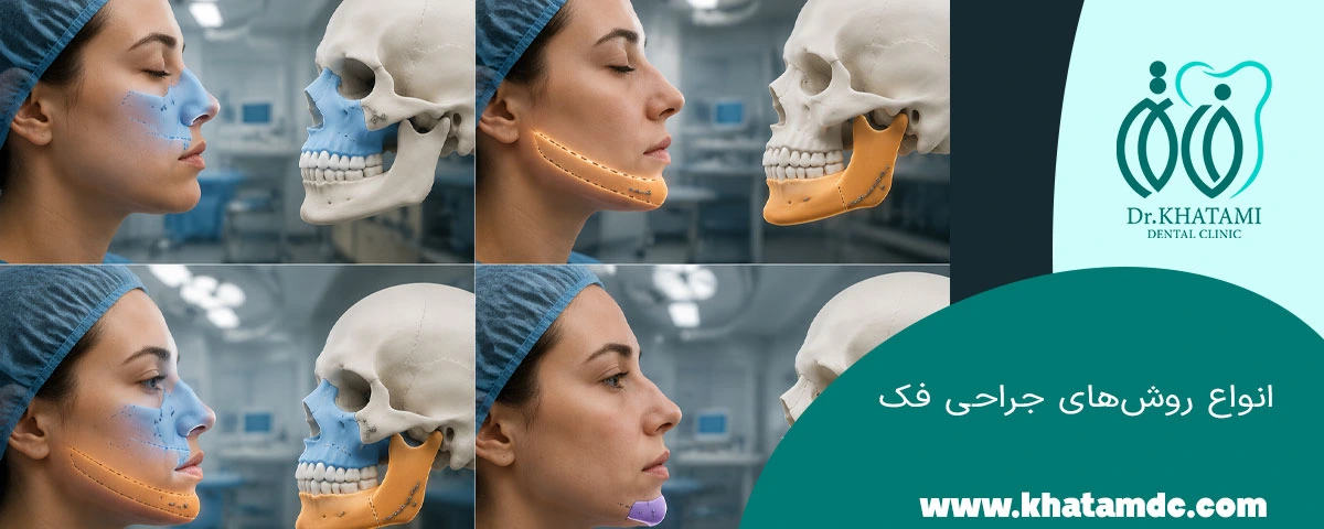 انواع جراحی فک