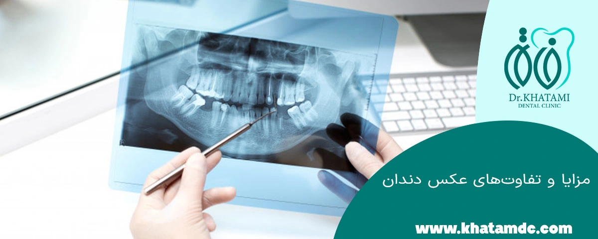 مزایای استفاده از رادیوگرافی دیجیتال در عکس دندان