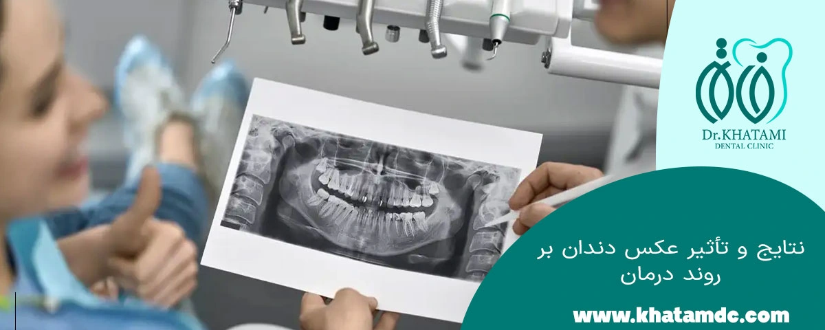 نتایج عکسبرداری دندان