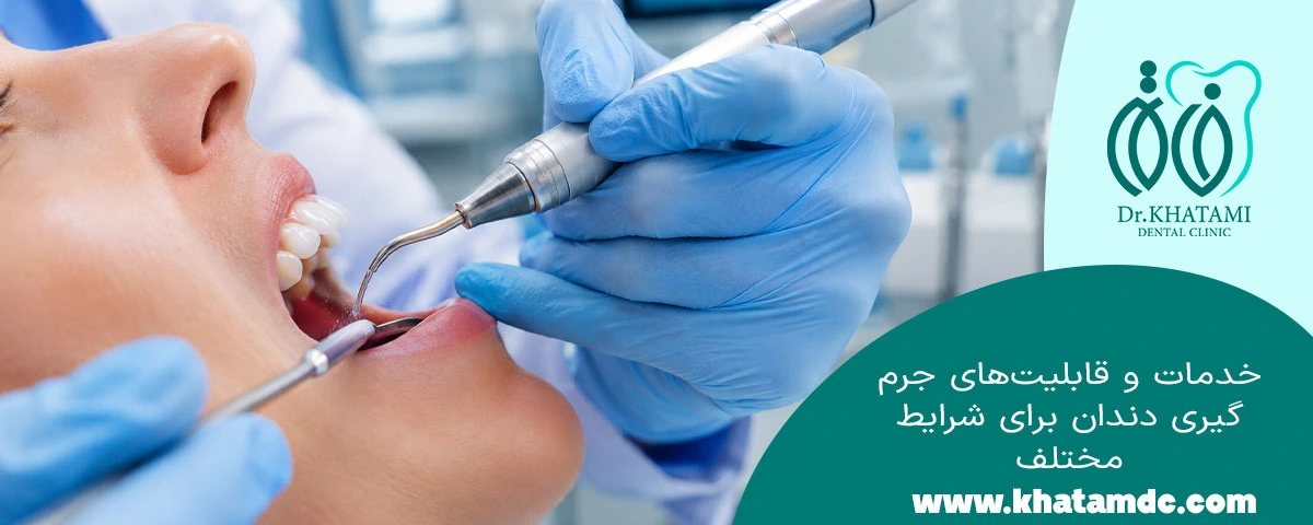 خدمات و قابلیت جرمگیری
