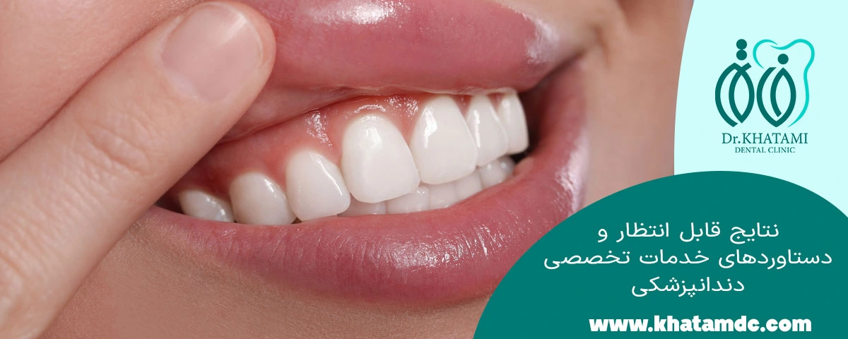 نتایج و دستاورد