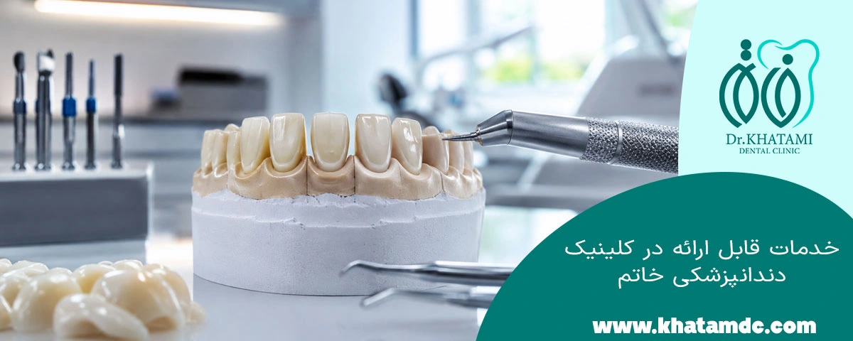 خدمات قابل ارائه